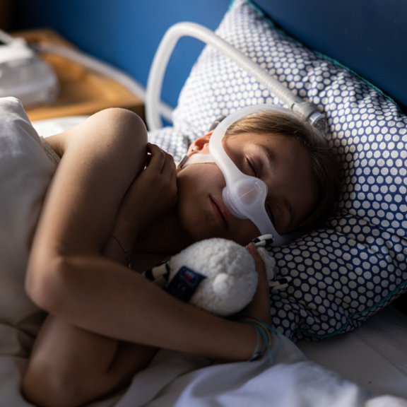 Obstructive sleep apnea in children - sleeping patient (girl) 1